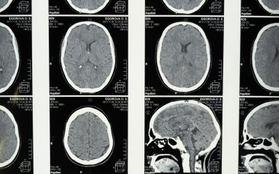 Vagus-informed Therapy Creates Conditions for A Person to Heal from Trauma